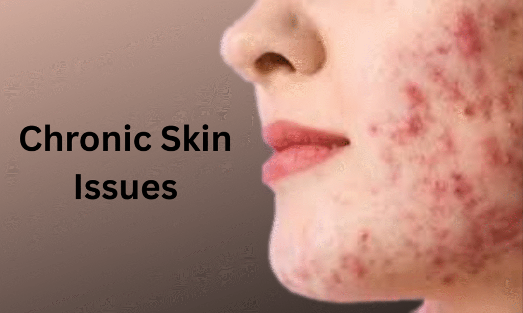 cronic skin issues